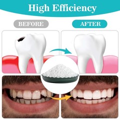Moldable False Teeth Beads – DIY Tooth Repair Kit for Chipped, Cracked Teeth